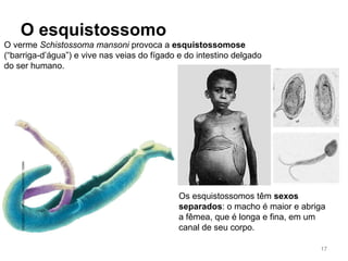 O esquistossomo
O verme Schistossoma mansoni provoca a esquistossomose
(“barriga-d’água”) e vive nas veias do fígado e do intestino delgado
do ser humano.
Os esquistossomos têm sexos
separados: o macho é maior e abriga
a fêmea, que é longa e fina, em um
canal de seu corpo.
NIBSC/SCIENCEPHOTOLIBRARY/LATINSTOCK
17
 