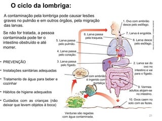O ciclo da lombriga:
Se não for tratada, a pessoa
contaminada pode ter o
intestino obstruído e até
morrer.
A contaminação pela lombriga pode causar lesões
graves no pulmão e em outros órgãos, pela migração
das larvas.
1. Ovo com embrião
desce pelo esôfago.
7. Larva é engolida.
8. Larva desce
pelo esôfago.
2. Larva sai do
ovo no
intestino e vai
para o fígado.
9. Vermes
adultos alojam-se
no intestino.
10. Ovos caem no
solo com as fezes.
Verduras são regadas
com água contaminada.
4. Larva passa
pelo coração.
3. Larva passa
pelo fígado.
5. Larva passa
pelo pulmão.
6. Larva passa
pela traqueia.
Ovo com embrião
é ingerido com
hortaliça.
INGEBORGASBACH/ARQUIVODAEDITORA
21
• PREVENÇÃO
• Instalações sanitárias adequadas
• Tratamento de água para beber e
cozinhar
• Hábitos de higiene adequados
• Cuidados com as crianças (não
deixar que levem objetos à boca)
 