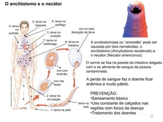 A perda de sangue faz o doente ficar
anêmico e muito pálido.
PREVENÇÃO:
•Saneamento básico
•Uso constante de calçados nas
regiões com focos da doença
•Tratamento dos doentes
5. larva na
traqueia
6. larva no
esôfago
3. larva no
coração
7. larva no
estômago
8. larva no
intestino
ovo no solo:
liberação de larva
ovo com
embrião
ovo nas
fezes
4. larva
no
pulmão
2. larva na
circulação
larva no
solo
NOEMIDECARVALHO/ARQUIVODAEDITORA
1. larva na pele
22
O ancilóstomo e o necátor
A ancilostomíase ou “amarelão” pode ser
causada por dois nematoides, o
ancilóstomo (Ancylostoma duodenale) e
o necátor (Necator americanus).
O verme se fixa na parede do intestino delgado
com e se alimenta do sangue da pessoa
contaminada.
 