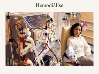 Hemodiálise
 