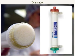 Dialisador
 