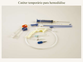 Catéter temporário para hemodiálise
 