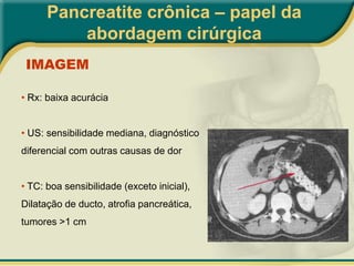 Pancreatite crônica – papel da abordagem cirúrgicaPancreatite crônica obstrutiva: estenoses cicatriciais, congênitas, traumáticas ou tumorais – sem calcificações