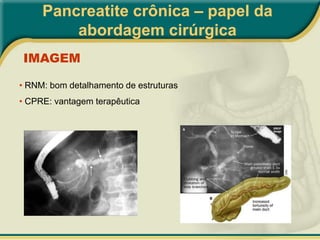 Pancreatite crônica inflamatória: etiologia desconhecida, progressiva, associada a febre, acometimento difuso exócrino