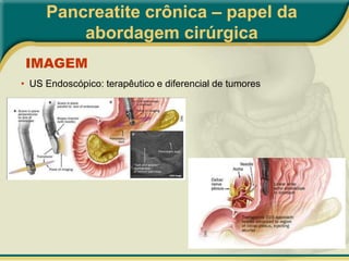  Outras causas: auto-imune, infecciosa, parasitária, hiperlipidemia, hepatopatiaMarseille – Roma (1988)