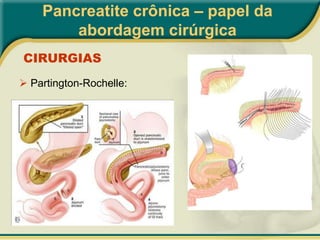  Síndrome disabsortiva