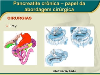  Icterícia discreta (pensar em Ca)