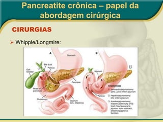  80-90% dos pacientes