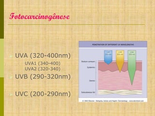 Fotocarcinogênese



UVA (320-400nm)
UVA1 (340-400)
UVA2 (320-340)



UVB (290-320nm)



UVC (200-290nm)

 