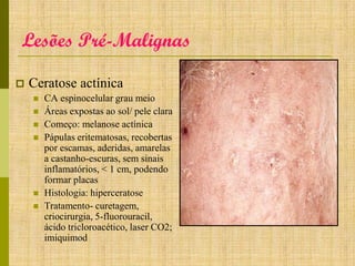 Lesões Pré-Malignas


Ceratose actínica








CA espinocelular grau meio
Áreas expostas ao sol/ pele clara
Começo: melanose actínica
Pápulas eritematosas, recobertas
por escamas, aderidas, amarelas
a castanho-escuras, sem sinais
inflamatórios, < 1 cm, podendo
formar placas
Histologia: hiperceratose
Tratamento- curetagem,
criocirurgia, 5-fluorouracil,
ácido tricloroacético, laser CO2;
imiquimod

 
