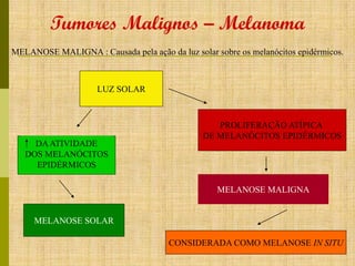 Tumores Malignos – Melanoma
MELANOSE MALIGNA : Causada pela ação da luz solar sobre os melanócitos epidérmicos.

LUZ SOLAR

DA ATIVIDADE
DOS MELANÓCITOS
EPIDÉRMICOS

PROLIFERAÇÃO ATÍPICA
DE MELANÓCITOS EPIDÉRMICOS

MELANOSE MALIGNA

MELANOSE SOLAR
CONSIDERADA COMO MELANOSE IN SITU

 