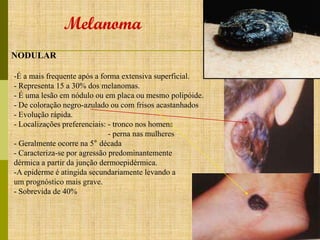 Melanoma
NODULAR
-É a mais frequente após a forma extensiva superficial.
- Representa 15 a 30% dos melanomas.
- É uma lesão em nódulo ou em placa ou mesmo polipóide.
- De coloração negro-azulado ou com frisos acastanhados
- Evolução rápida.
- Localizações preferenciais: - tronco nos homens
- perna nas mulheres
- Geralmente ocorre na 5° década
- Caracteriza-se por agressão predominantemente
dérmica a partir da junção dermoepidérmica.
-A epiderme é atingida secundariamente levando a
um prognóstico mais grave.
- Sobrevida de 40%

 