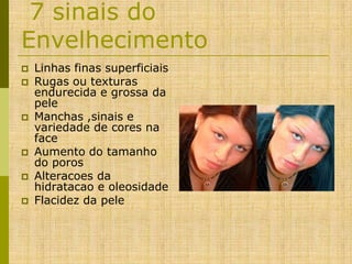 7 sinais do
Envelhecimento










Linhas finas superficiais
Rugas ou texturas
endurecida e grossa da
pele
Manchas ,sinais e
variedade de cores na
face
Aumento do tamanho
do poros
Alteracoes da
hidratacao e oleosidade
Flacidez da pele

 