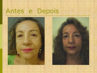 Antes e Depois

 