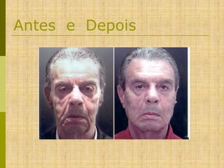 Antes e Depois

 