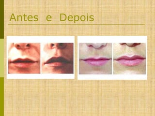 Antes e Depois

 