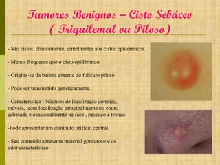 Tumores Benignos – Cisto Sebáceo
( Triquilemal ou Piloso)
- São cistos, clinicamente, semelhantes aos cistos epidérmicos.
- Menos frequente que o cisto epidérmico.
- Origina-se da bainha externa do folículo piloso.

- Pode ser transmitido geneticamente.
- Característica : Nódulos de localização dérmica,
móveis, com localização principalmente no couro
cabeludo e ocasionalmente na face , pescoço e tronco.
-Pode apresentar um diminuto orifício central.
- Seu conteúdo apresenta material gorduroso e de
odor característico

 