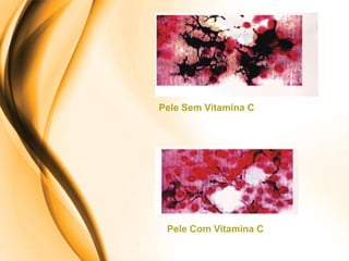 Pele Sem Vitamina C




 Pele Com Vitamina C
 