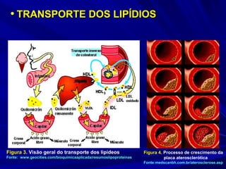 • TRANSPORTE DOS LIPÍDIOSTRANSPORTE DOS LIPÍDIOS
Figura 3.Figura 3. Visão geral do transporte dos lipídeosVisão geral do transporte dos lipídeos
Fonte: www.geocities.com/bioquimicaaplicada/resumoslipoproteinasFonte: www.geocities.com/bioquimicaaplicada/resumoslipoproteinas
Figura 4. Processo de crescimento da
placa aterosclerótica
Fonte:medscanbh.com.br/aterosclerose.asp
 