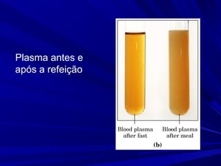 Plasma antes e
após a refeição
 
