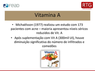 Vitamina A
• Michaëlsson (1977) realizou um estudo com 173
pacientes com acne – maioria apresentou níveis séricos
reduzidos de Vit. A
• Após suplementação com Vit A (300mil UI), houve
diminuição significativa do número de infiltrados e
comedões
 