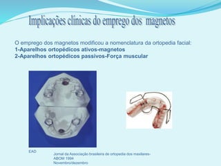 O emprego dos magnetos modificou a nomenclatura da ortopedia facial:
1-Aparelhos ortopédicos ativos-magnetos
2-Aparelhos ortopédicos passivos-Força muscular
EAD (Botler)
Jornal da Associação brasileira de ortopedia dos maxilares-
ABOM 1994
Novembro/dezembro
 