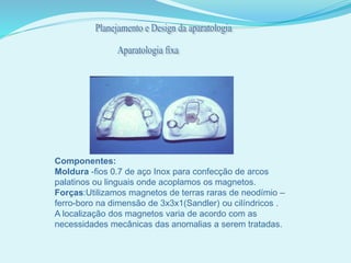 Componentes:
Moldura -fios 0.7 de aço Inox para confecção de arcos
palatinos ou linguais onde acoplamos os magnetos.
Forças:Utilizamos magnetos de terras raras de neodímio –
ferro-boro na dimensão de 3x3x1(Sandler) ou cilíndricos .
A localização dos magnetos varia de acordo com as
necessidades mecânicas das anomalias a serem tratadas.
 
