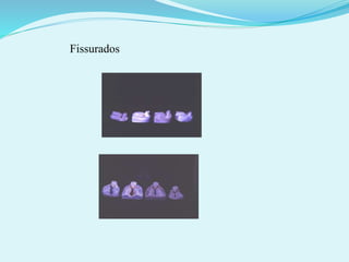 Fissurados
 
