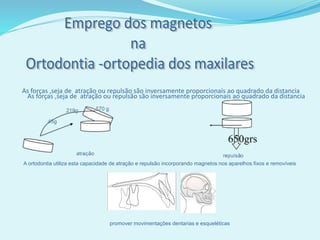 As forças ,seja de atração ou repulsão são inversamente proporcionais ao quadrado da distancia
promover movimentações dentarias e esqueléticas
A ortodontia utiliza esta capacidade de atração e repulsão incorporando magnetos nos aparelhos fixos e removíveis
As forças ,seja de atração ou repulsão são inversamente proporcionais ao quadrado da distancia
 