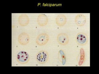 P. falciparum 