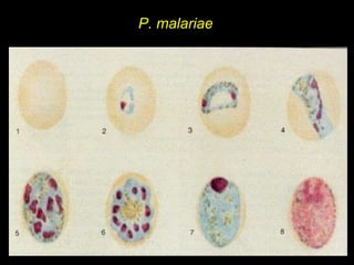P. malariae 