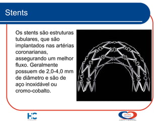 Stents
Os stents são estruturas
tubulares, que são
implantados nas artérias
coronarianas,
assegurando um melhor
fluxo. Geralmente
possuem de 2,0-4,0 mm
de diâmetro e são de
aço inoxidável ou
cromo-cobalto.

 