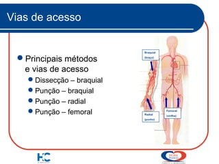 Vias de acesso

Principais métodos
e vias de acesso
Dissecção – braquial
Punção – braquial
Punção – radial
Punção – femoral

Braquial
(braço)

Femoral
Radial
(punho)

(virilha)

 