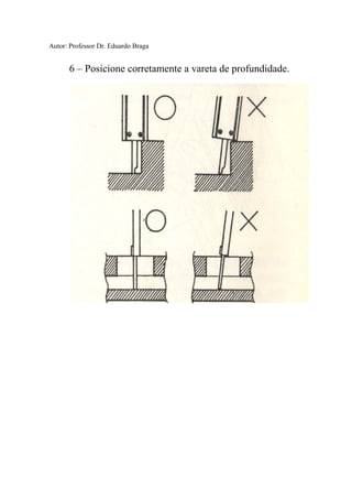 Autor: Professor Dr. Eduardo Braga
6 – Posicione corretamente a vareta de profundidade.
 