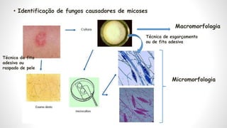O que analisar macroscopicamente em cultura de fungo leveduriforme?
 Colônias são esféricas ou ovais;
 Consistência past...