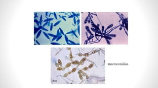 Micromorfologia de fungos filamentosos (bolores)
 