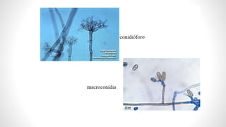 Macromorfologia de fungos leveduriformes
 