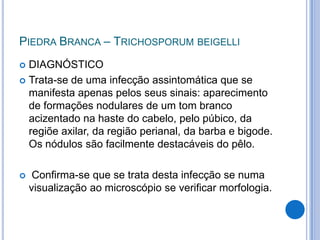 PIEDRA BRANCA – TRICHOSPORUM BEIGELLI
 DIAGNÓSTICO
 Trata-se de uma infecção assintomática que se
manifesta apenas pelos seus sinais: aparecimento
de formações nodulares de um tom branco
acizentado na haste do cabelo, pelo púbico, da
regiõe axilar, da região perianal, da barba e bigode.
Os nódulos são facilmente destacáveis do pêlo.
 Confirma-se que se trata desta infecção se numa
visualização ao microscópio se verificar morfologia.
 