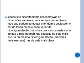  lesões são discretamente descamativas de
dimensões variáveis, nem sempre perceptíveis,
mas que podem aumentar e tendem a coalescer. A
cor da lesão na pele pode variar de
hipopigmentação (manchas brancas ou mais claras
do que a pele normal) nas pessoas de pele mais
escura ou mesmo hiperpigmentação (manchas
mais escuras) nas de pele mais clara
 