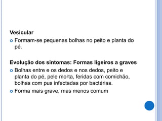 Vesicular
 Formam-se pequenas bolhas no peito e planta do
pé.
Evolução dos sintomas: Formas ligeiros a graves
 Bolhas entre e os dedos e nos dedos, peito e
planta do pé, pele morta, feridas com comichão,
bolhas com pus infectadas por bactérias.
 Forma mais grave, mas menos comum
 