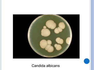 Candida albicans
 