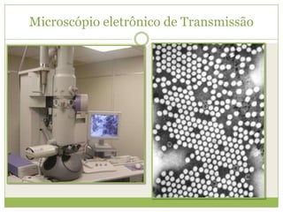 Microscópio eletrônico de Transmissão
 