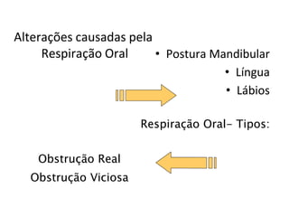 Alterações causadas pela
Respiração Oral • Postura Mandibular
• Língua
• Lábios
Obstrução Real
Obstrução Viciosa
Respiração Oral- Tipos:
 