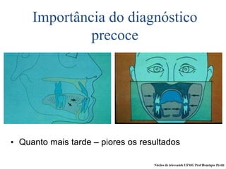 Importância do diagnóstico
precoce
• Quanto mais tarde – piores os resultados
 