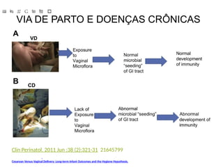 VIA DE PARTO E DOENÇAS CRÔNICAS
Clin Perinatol. 2011 Jun ;38 (2):321-31 21645799
Cesarean Versus Vaginal Delivery: Long-term Infant Outcomes and the Hygiene Hypothesis.
 