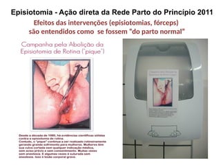 Episiotomia - Ação direta da Rede Parto do Princípio 2011
Efeitos das intervenções (episiotomias, fórceps)
são entendidos como se fossem “do parto normal”
 
