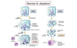 Necrose Vs. Apoptose
 