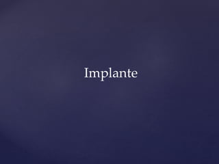 Implante
 