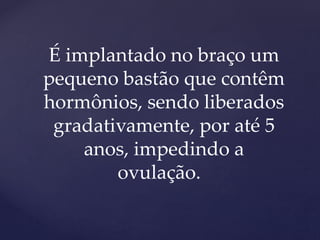 É implantado no braço um
pequeno bastão que contêm
hormônios, sendo liberados
gradativamente, por até 5
anos, impedindo a
ovulação.
 