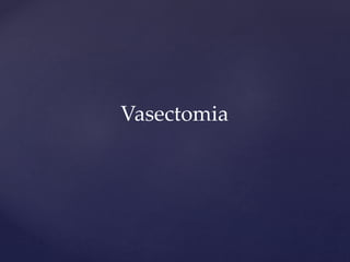 Vasectomia
 